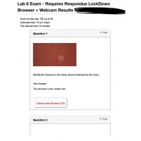 BIOD 152 A & P II Lab 6 Exam - Portage Learning 2 (32 out of 40)