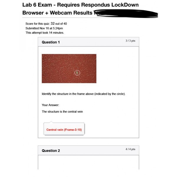 BIOD 152 A & P II Lab 6 Exam - Portage Learning 2 (32 out of 40)