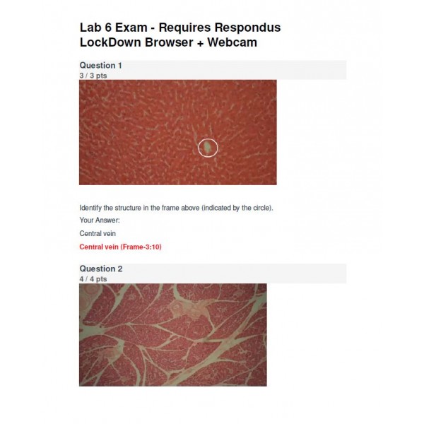 BIOD 152 A & P II Lab 6 Exam - Portage Learning (37 out of 40)
