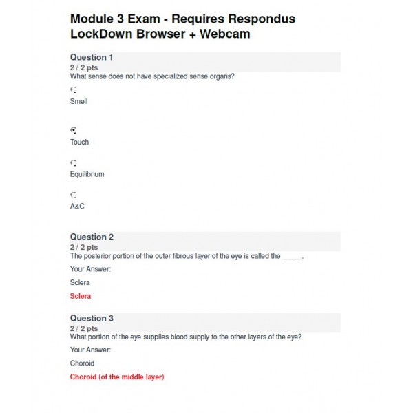 BIOD 152 A & P II Module 3 Exam - Portage Learning (93 out of 100)